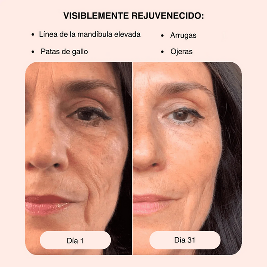 Combo Reafirmador de piel MAXFACE®😍